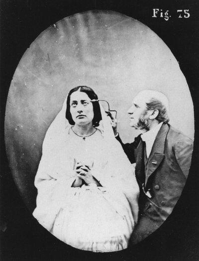1876年に発行されたパリのデュシェンヌドブローニュによる「Physionomie de la Physionomie humaine ou analyze electrophysiologique des passions」からの生理学的検査 作： Guillaume Benjamin Armand Duchenne de Boulogne